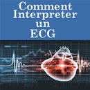 Comment Interpreter un ECG APK