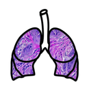 Lung Cancer Stage APK
