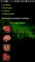 Zombie Survival Guide Lite 截圖 1