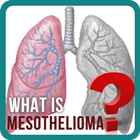 Mesothelioma Solution Zeichen
