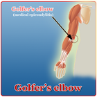 Golfers Elbow 图标