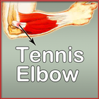 Tennis Elbow icône