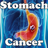 Stomach Cancer