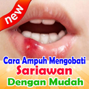Cara Ampuh Mengobati Sariawan Dengan Mudah Alami aplikacja