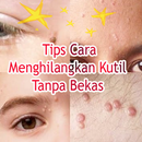 Tips Cara Menghilangkan Kutil Tanpa Bekas aplikacja