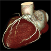 CARDIAC CT TECHNIQUE