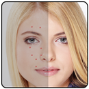 Pimple remover,Acne remover Acne app Photo Editor APK