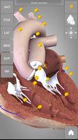 Heart 3D Anatomy Lite Affiche