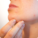 ঘরোয়া পদ্ধতিতে ব্রনের চিকিৎসা APK