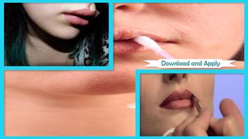 Natural Lips Instant Treatment تصوير الشاشة 2