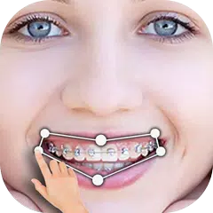 Braces Studio