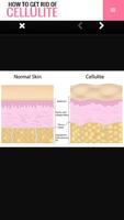 How to Get Rid of Cellulite скриншот 3