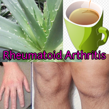 Rheumatoid Arthritis Zeichen