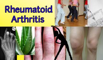 Rheumatoid Arthritis screenshot 1