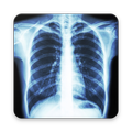 CHEST RADIOLOGY