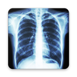 CHEST RADIOLOGY ikon