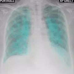 Chest X-Ray And Pathology