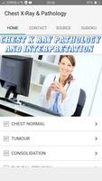 Chest X-Ray And Pathology ảnh chụp màn hình 1