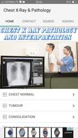 Chest X-Ray And Pathology स्क्रीनशॉट 2