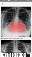 3 Schermata Chest X-Ray And Pathology