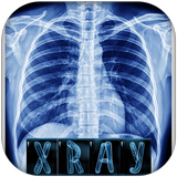 Chest X-ray interpretation