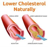 Total Cholesterol Medications Affiche
