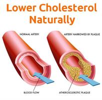 Total Cholesterol Medications постер