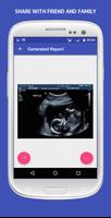 UltraSound Spoof 截图 2