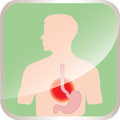 Heartburn, Acid Reflux - Recommendations