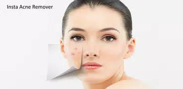 Face Acne Remover Photo Editor