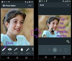 برنامه‌نما Face Acne Remover Photo Editor عکس از صفحه