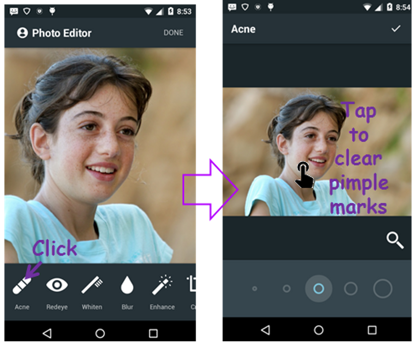Face Acne Remover Photo Editor App screenshot 1