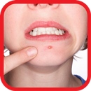 Сrush Acne and Zits. Squeeze Pimples. Clear Faces APK