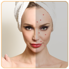 Pimple Remover Acne Remover أيقونة