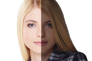 Pimple Remover Acne Remover تصوير الشاشة 2