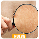 Como Quitar Las Estrías APK