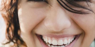 Blanqueamiento Dental en Casa اسکرین شاٹ 3