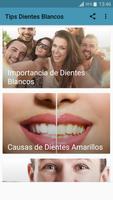 Tips Dientes Blancos plakat