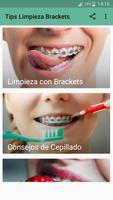 Tips Limpieza Brackets ポスター