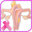 Cáncer de cuello uterino APK