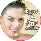 How To Stop Acne icône