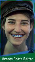 Braces Free – Photo Editor اسکرین شاٹ 1