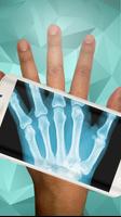 Xray Scanner Prank Affiche