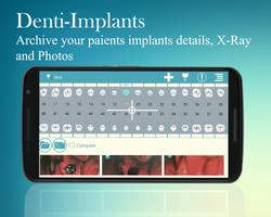 Denti-Implants poster