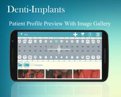 Denti-Implants screenshot 1