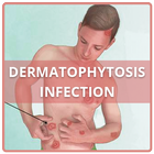 Dermatophytosis Infection icône