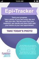 Epi-Tracker Cartaz