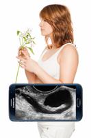 Scanner Pregnant X-ray Prank Affiche