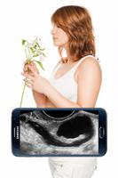Scanner Pregnant X-ray Prank پوسٹر