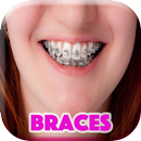 Real Braces teeth Selfie Camer APK